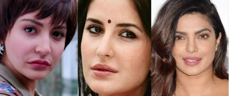 Top 8 Bollywood Celebrities Before & After plastic surgery pics