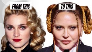 10 Beauty Botox Obsessed Celebs