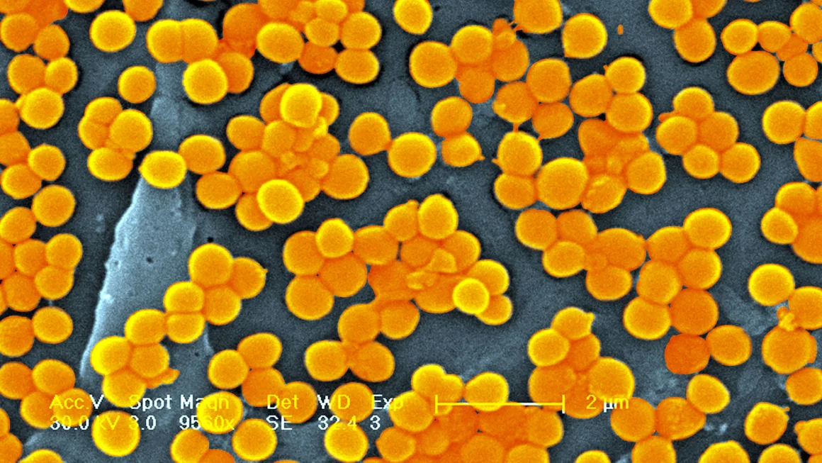 The Growing Threat of Antimicrobial Resistance and Impact